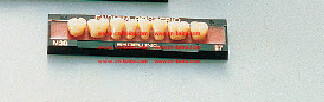 Shofu endura posterio 1 row dental laboratory